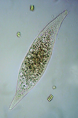 Amphileptus pleurosigma