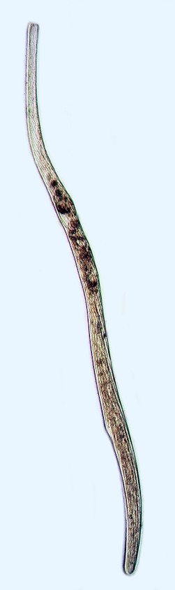 Spirostomum sp.